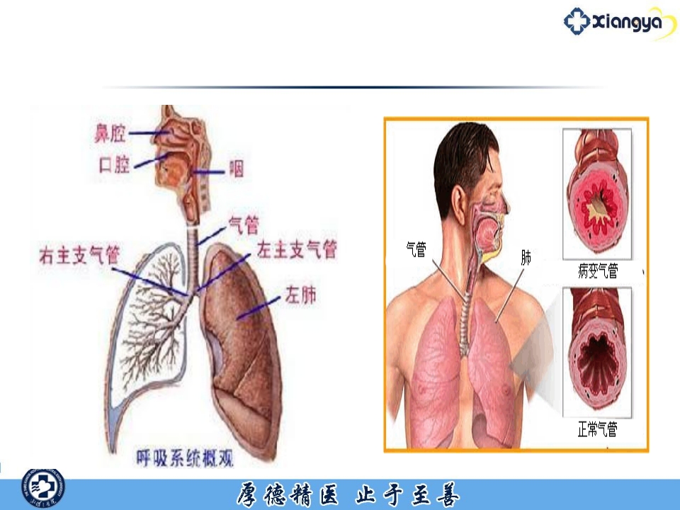 急性严重哮喘的监护