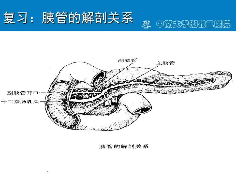 急性重症胰腺炎