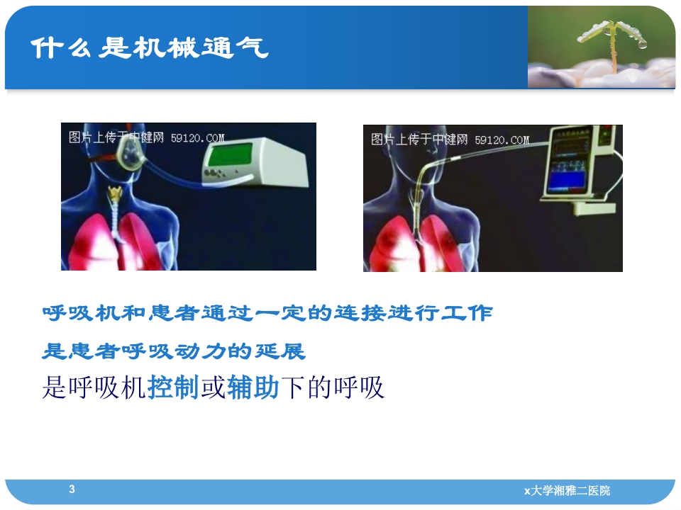 人工呼吸机监测技术