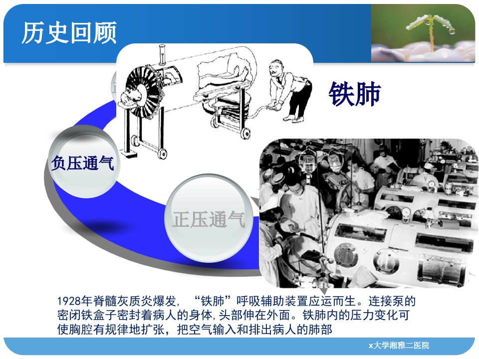 人工呼吸机监测技术