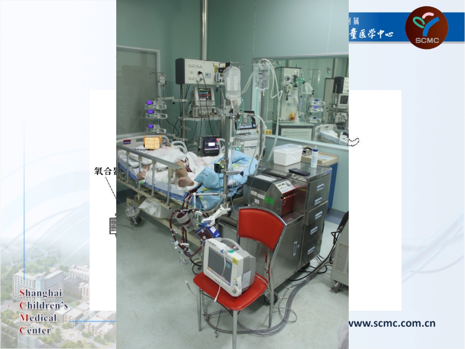 体外生命支持设备在重症监护室的使用CICU