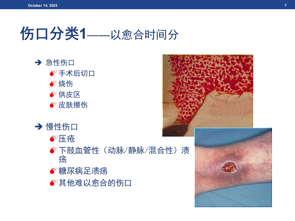 伤口基础知识、湿性愈合理论及伤口的评估与治疗