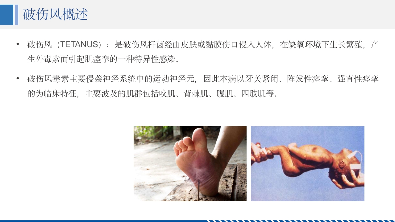 破伤风患者护理查房