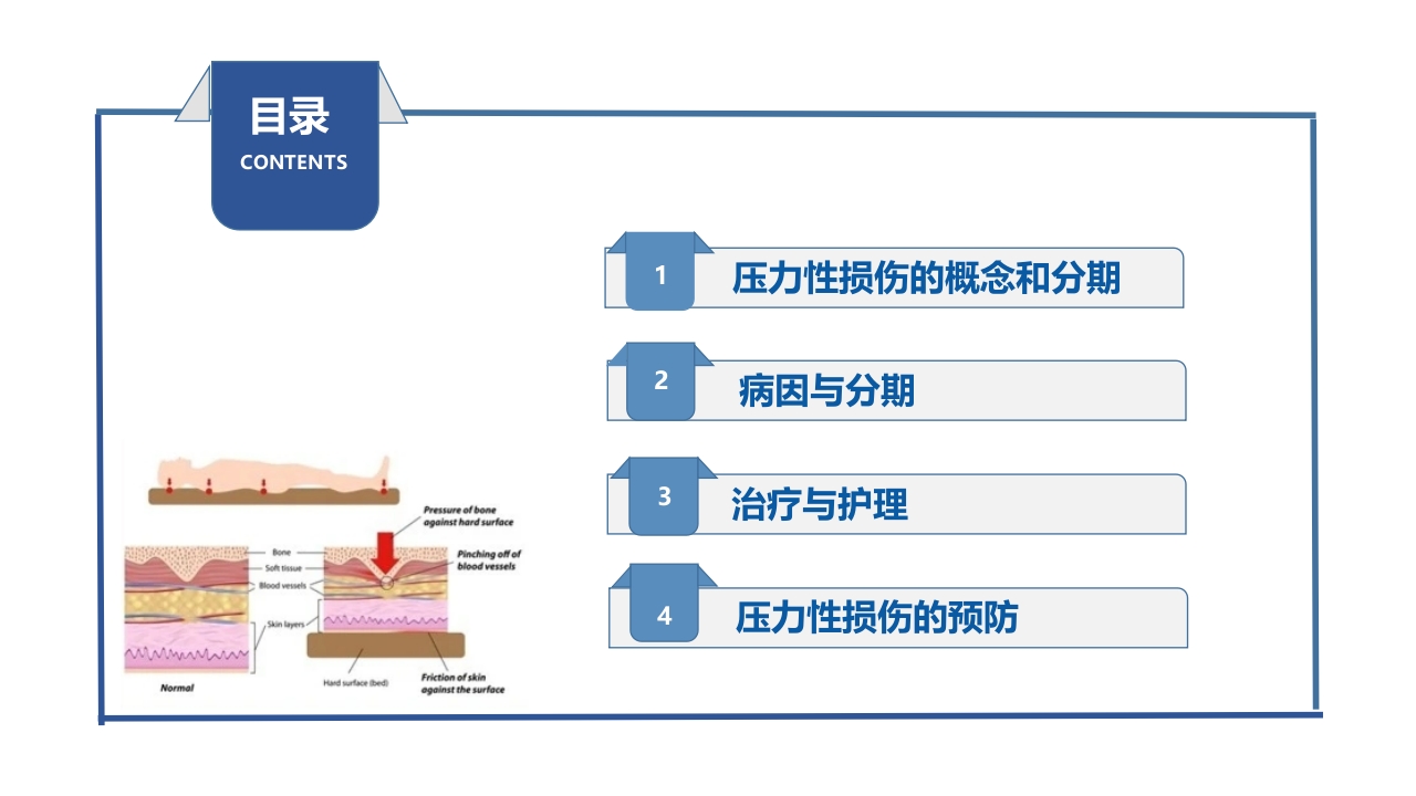 压力性损伤预防及护理