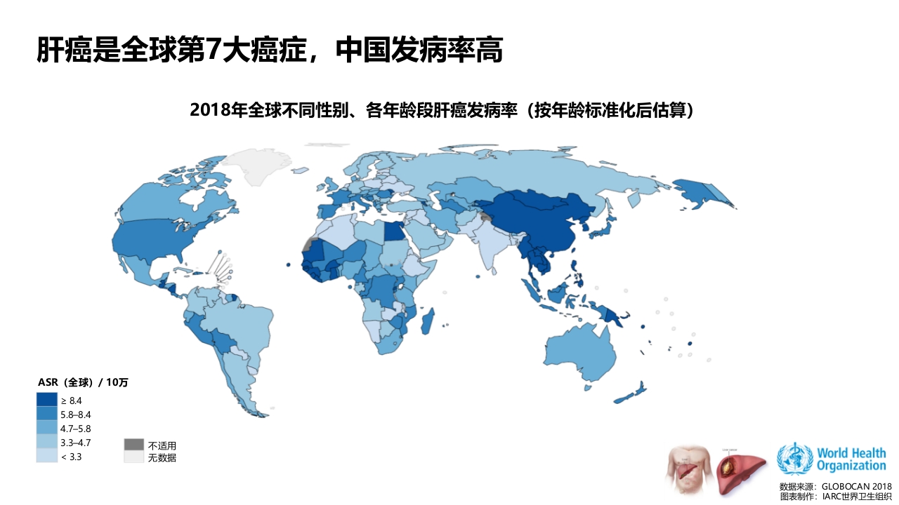 【肿瘤笔记】原发性肝癌