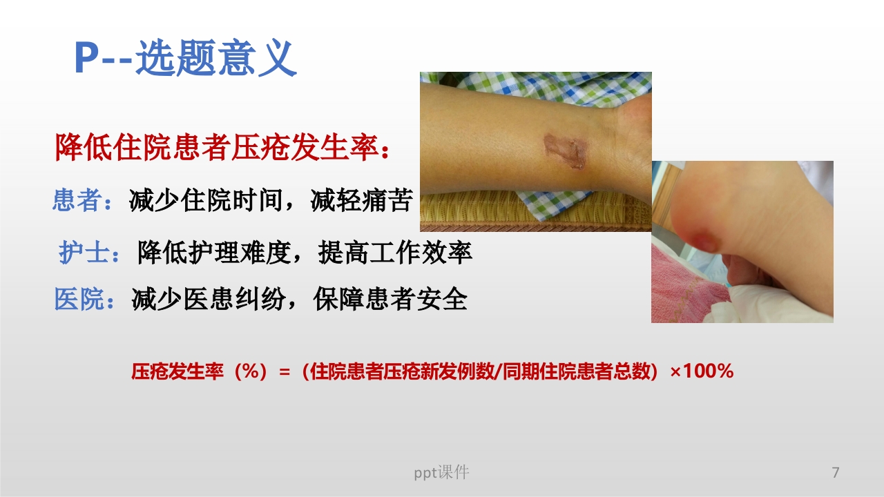 (护理部PDCA改进项目模版)降低住院患者压疮发生率