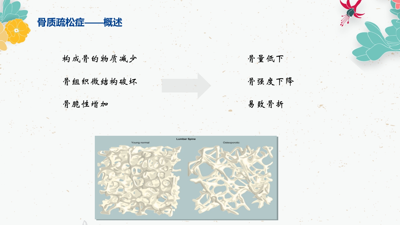 骨质疏松的药物治疗