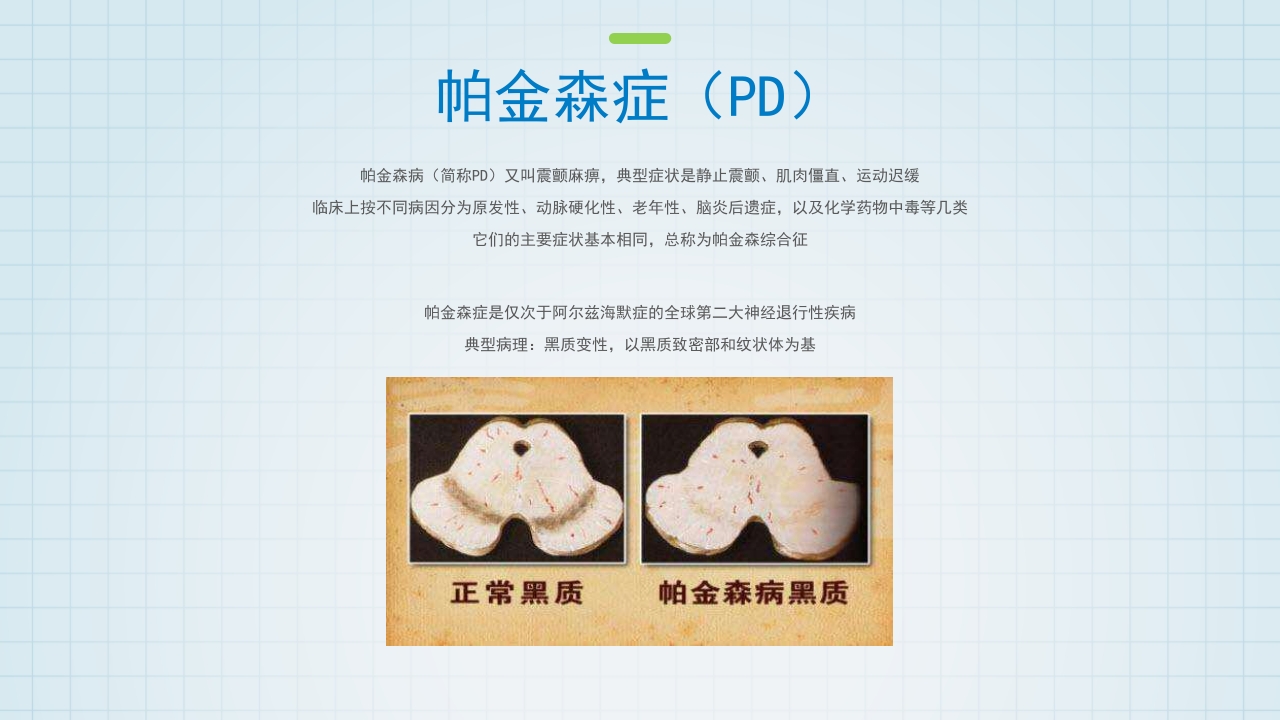 帕金森药物治疗