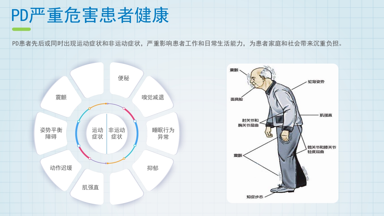 帕金森药物治疗