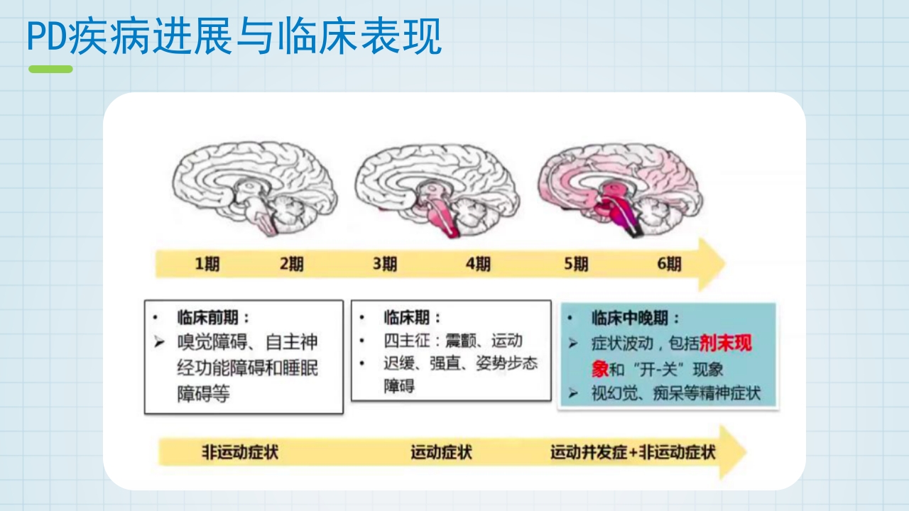 帕金森药物治疗