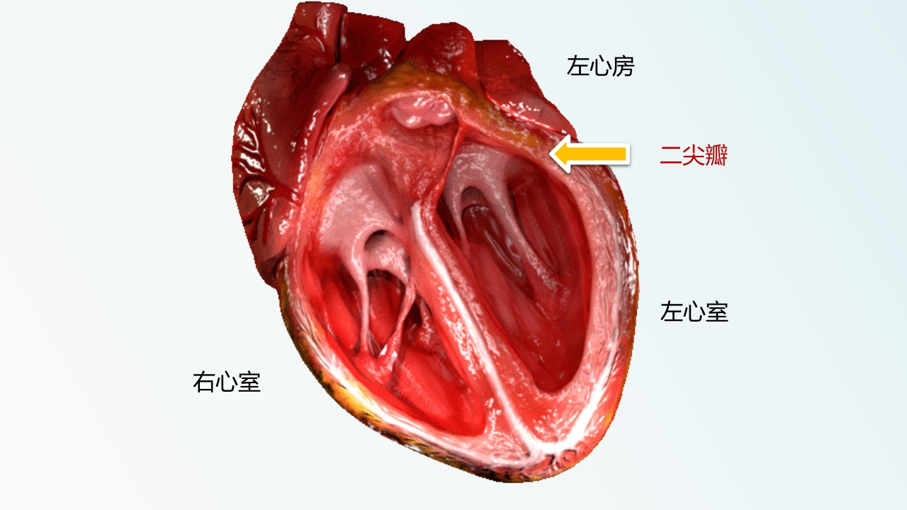 北京高校青年教师教学比赛获奖课件-医学类-二尖瓣狭窄【27页】_20324129