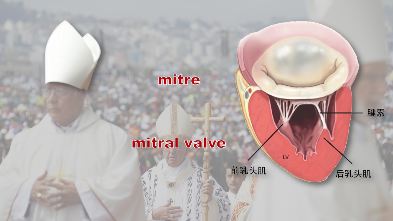 北京高校青年教师教学比赛获奖课件-医学类-二尖瓣狭窄【27页】_20324129