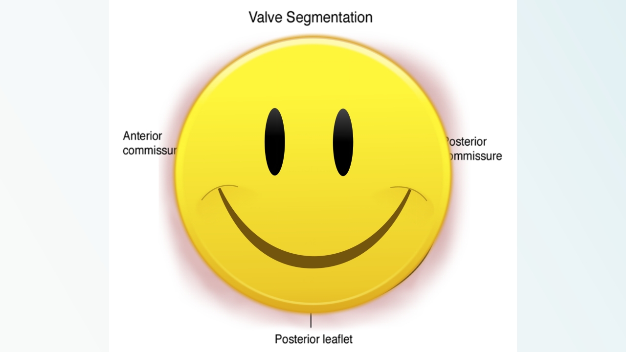 北京高校青年教师教学比赛获奖课件-医学类-二尖瓣狭窄【27页】_20324129