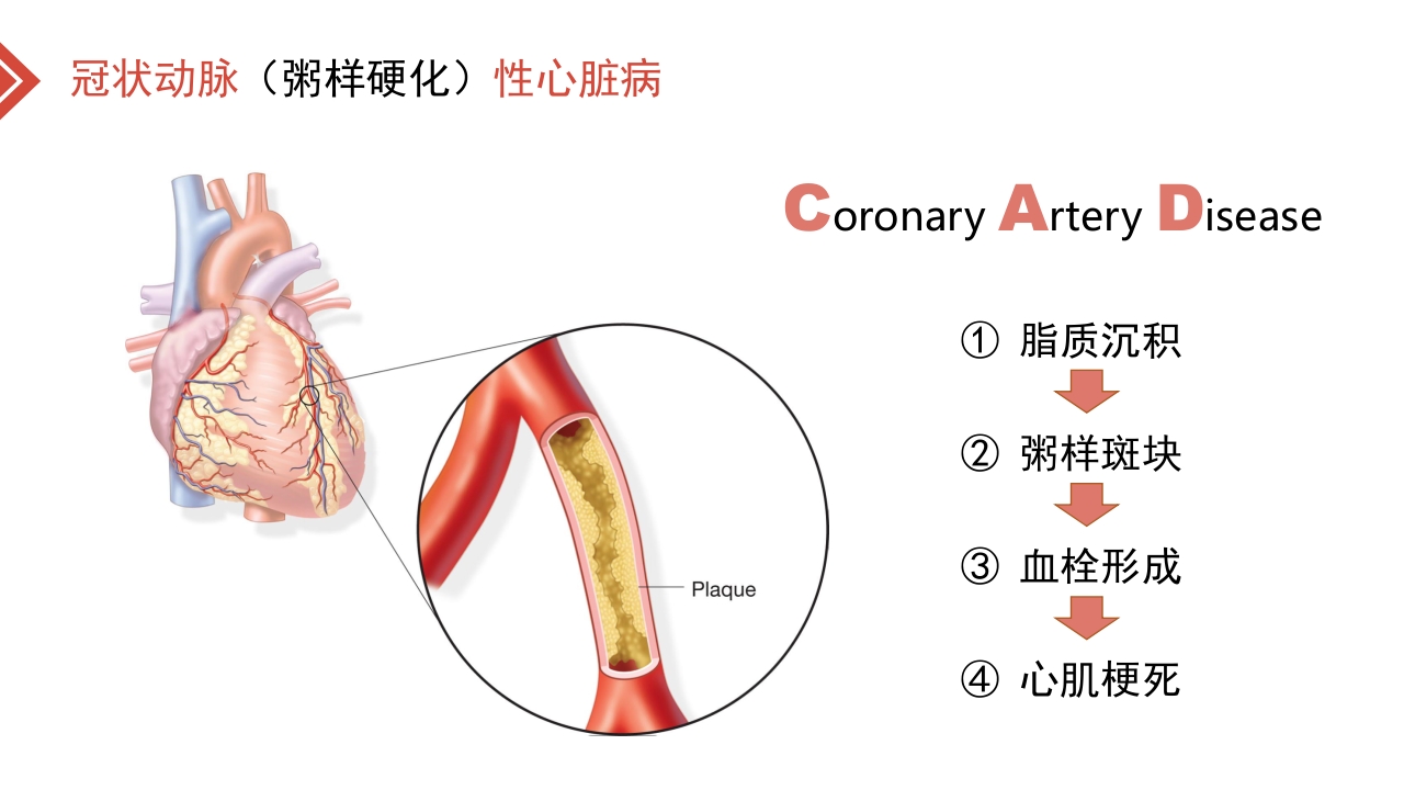 北京高校青年教师教学比赛获奖课件-医学类-冠心病的外科治疗