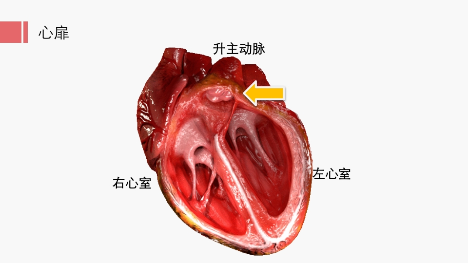 北京高校青年教师教学比赛获奖课件-医学类-主动脉瓣狭窄【27页】_20324130