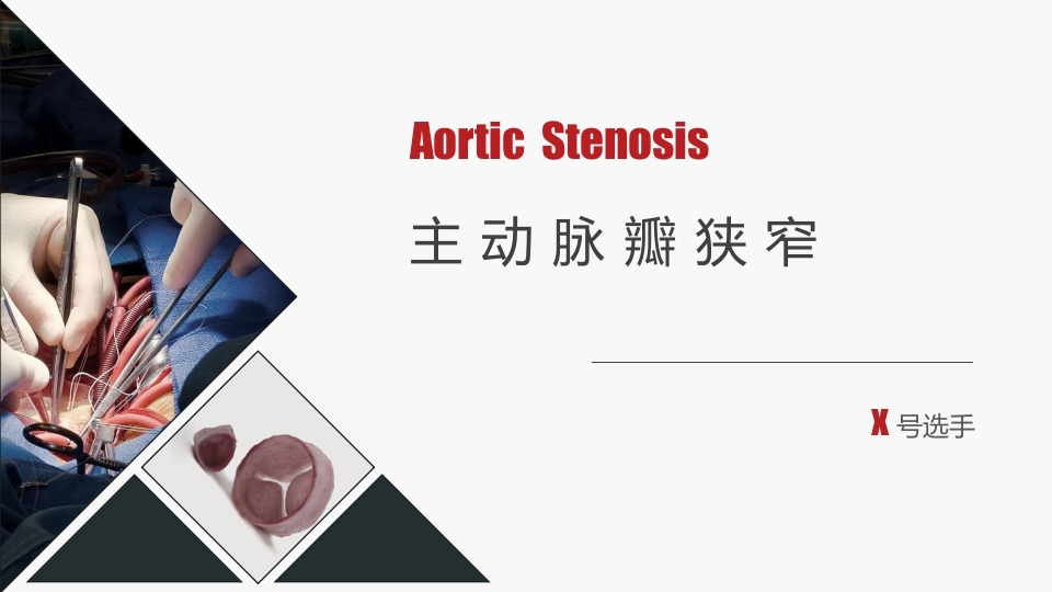 北京高校青年教师教学比赛获奖课件-医学类-主动脉瓣狭窄【27页】_20324130