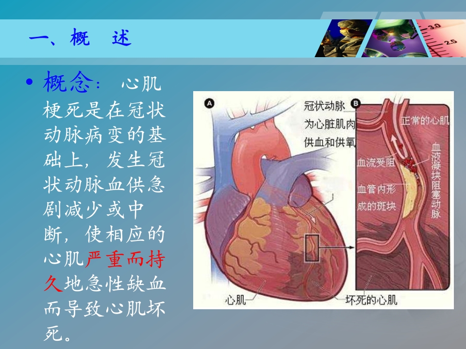 全国“创新杯”医药卫生类类说课大赛课件特等奖作品：心肌梗死课件