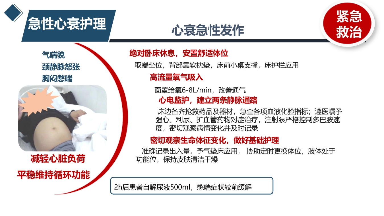 1例风湿性心脏病合并大量腹水患者的护理