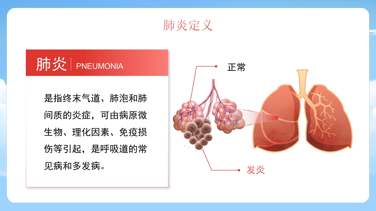 肺炎感染护理培训