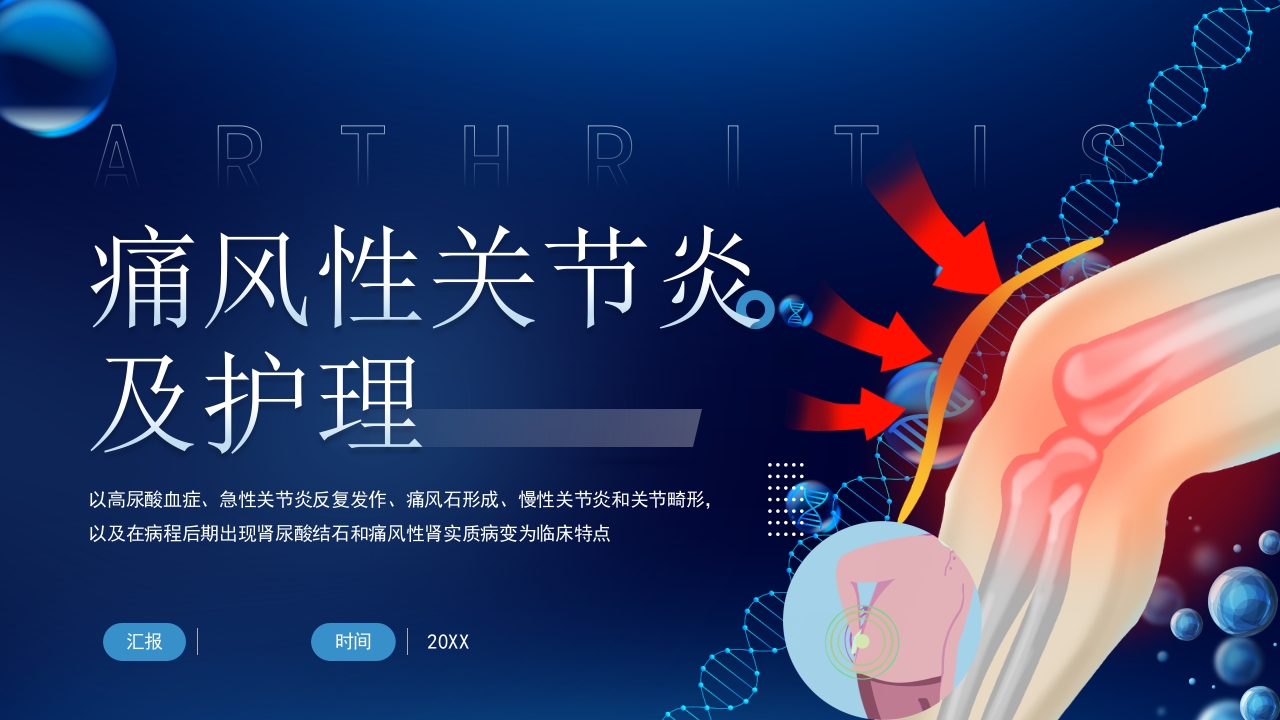 痛风性关节炎及护理