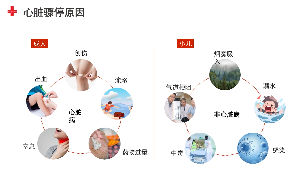 生命的“重启”魔法：心肺复苏(CPR)