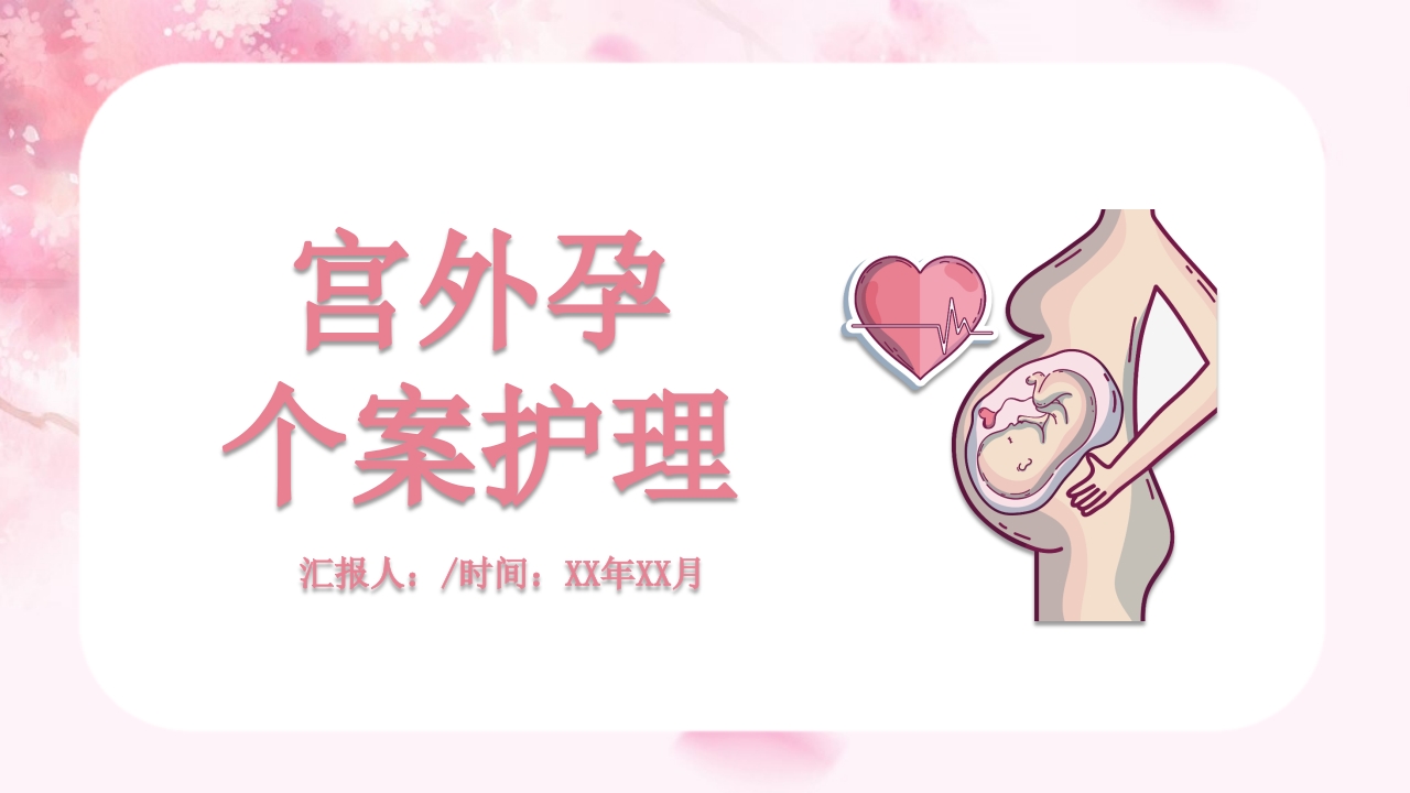 宫外孕个案护理查房汇报