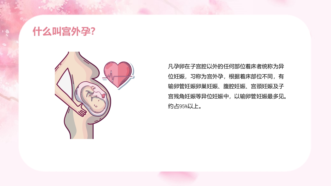 宫外孕个案护理查房汇报