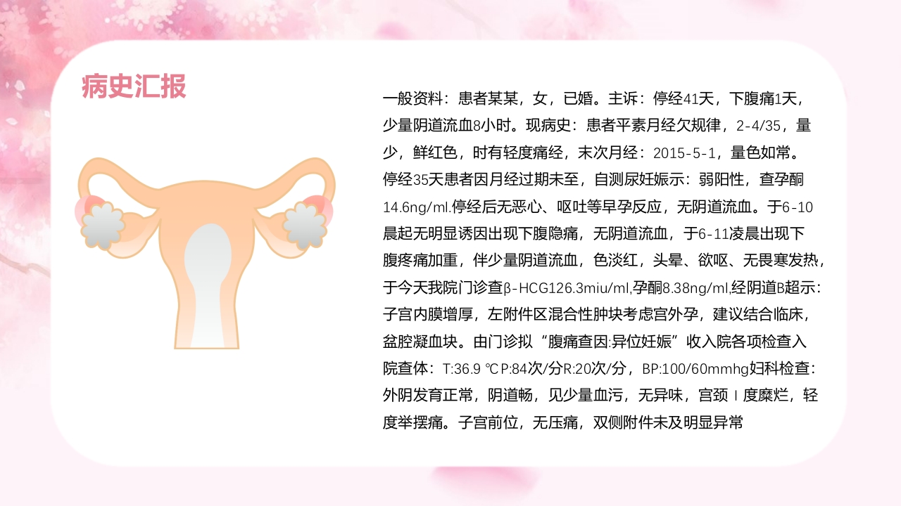 宫外孕个案护理查房汇报