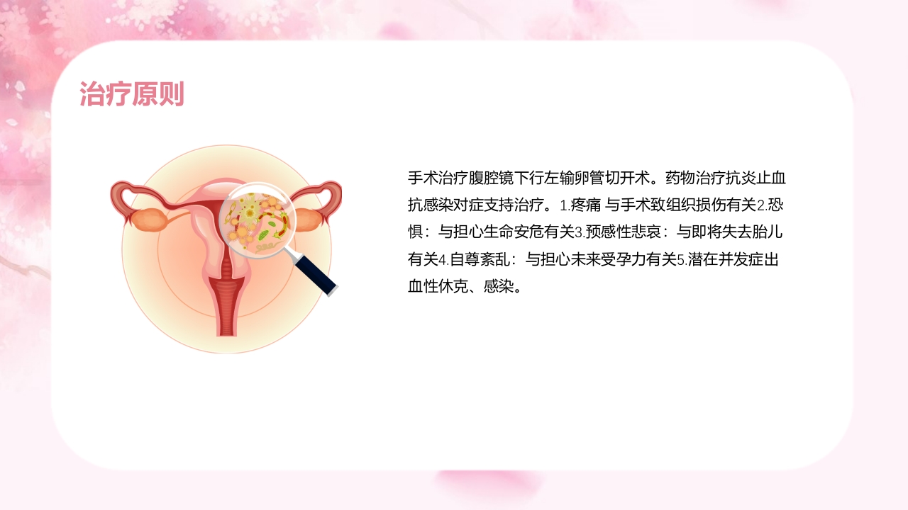 宫外孕个案护理查房汇报