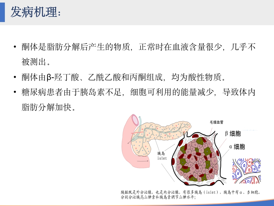 糖尿病酮症酸中毒的护理查房