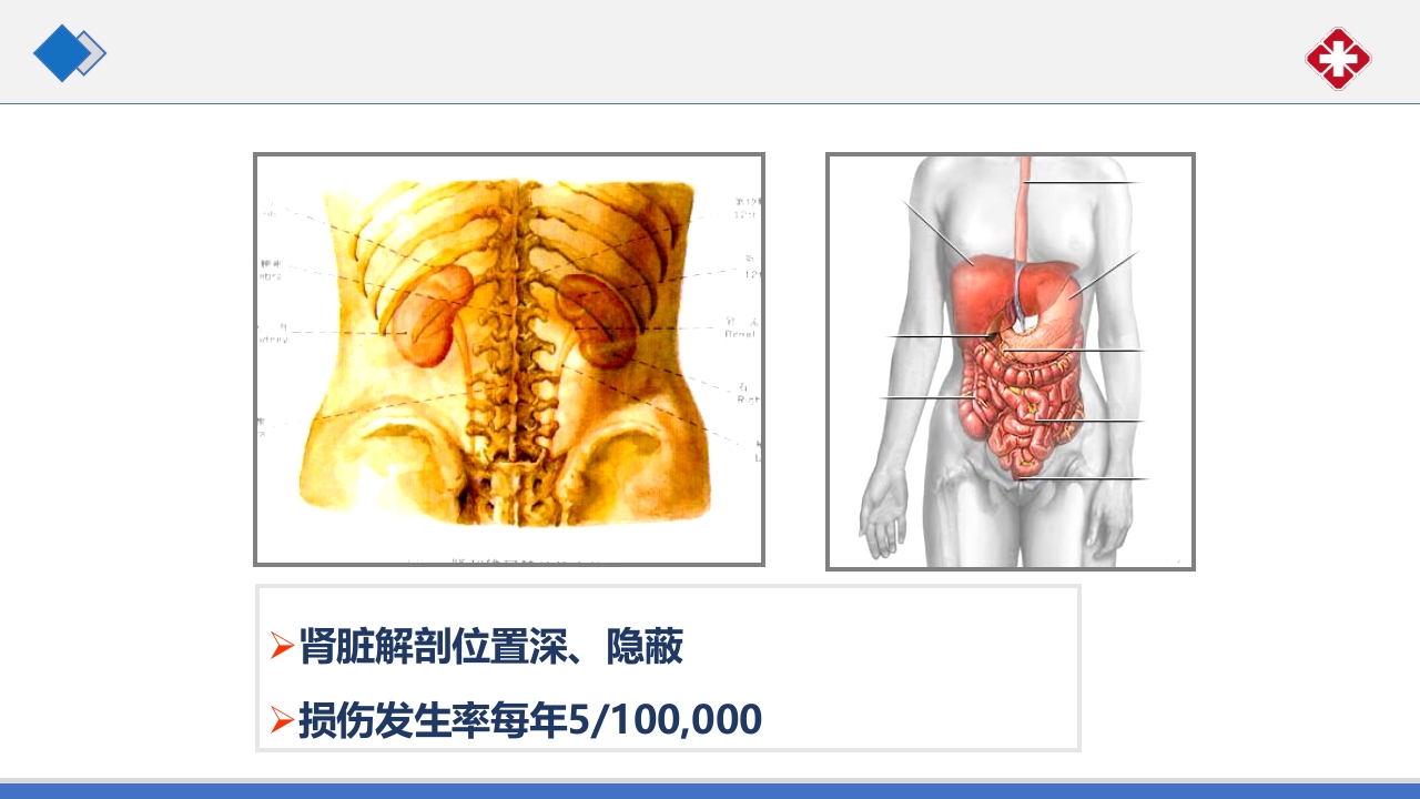 肾脏损伤的诊治(肾创伤)