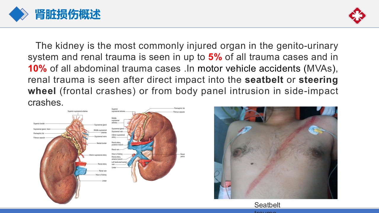 肾脏损伤的诊治(肾创伤)