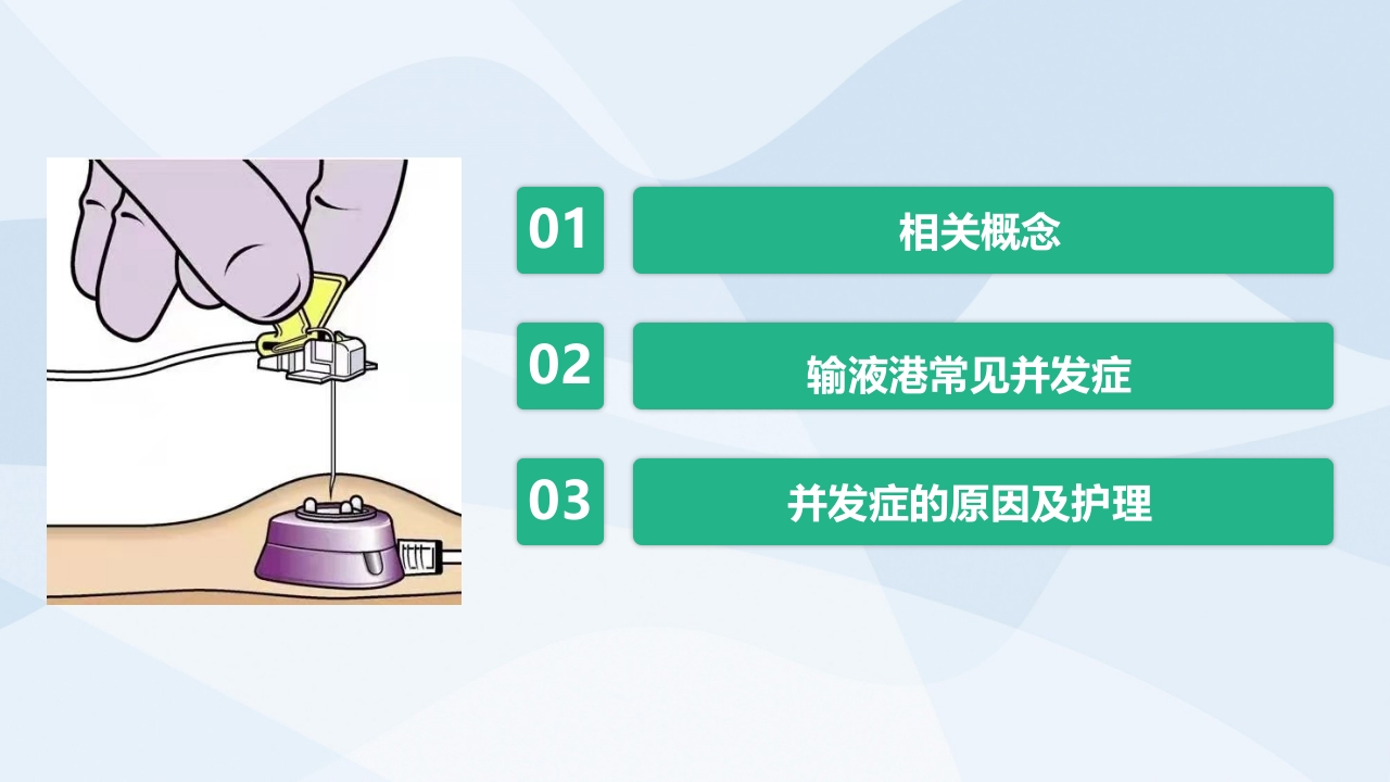 植入式静脉输液港的并发症及护理