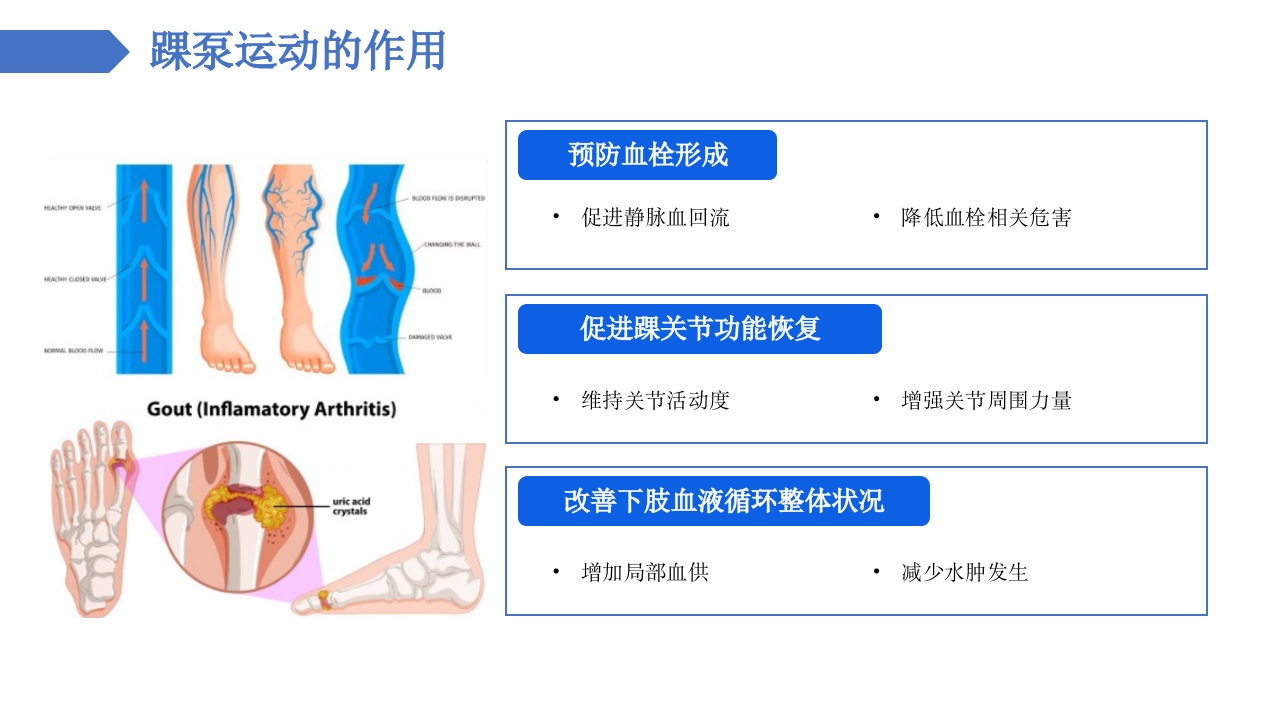 踝泵运动健康宣教