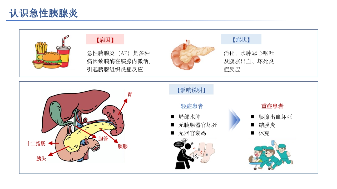 急性胰腺炎相关知识