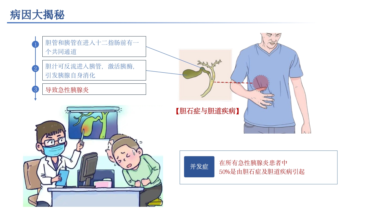 急性胰腺炎相关知识