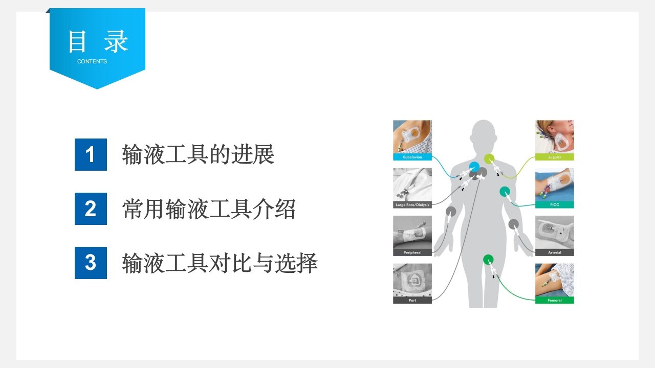 静脉输液工具的合理选择