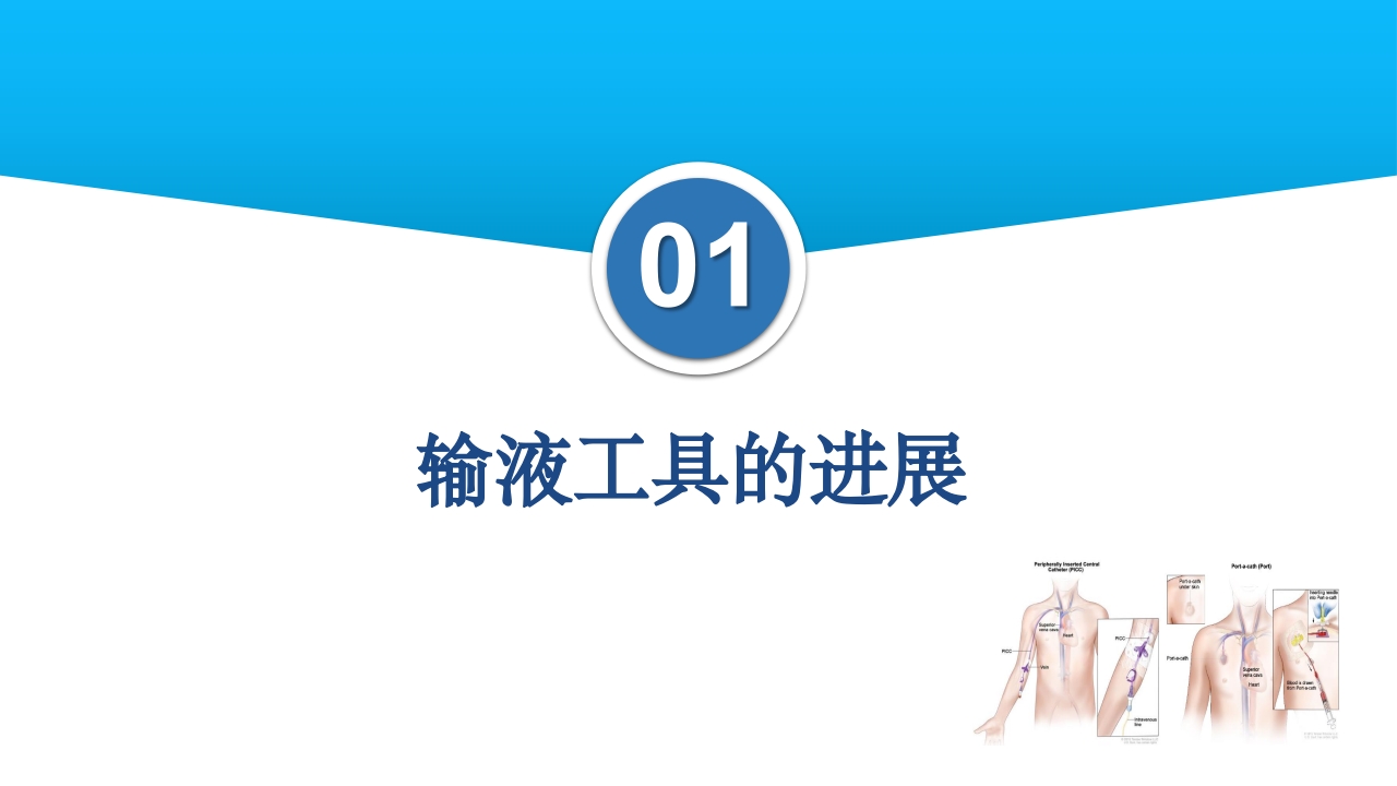 静脉输液工具的合理选择