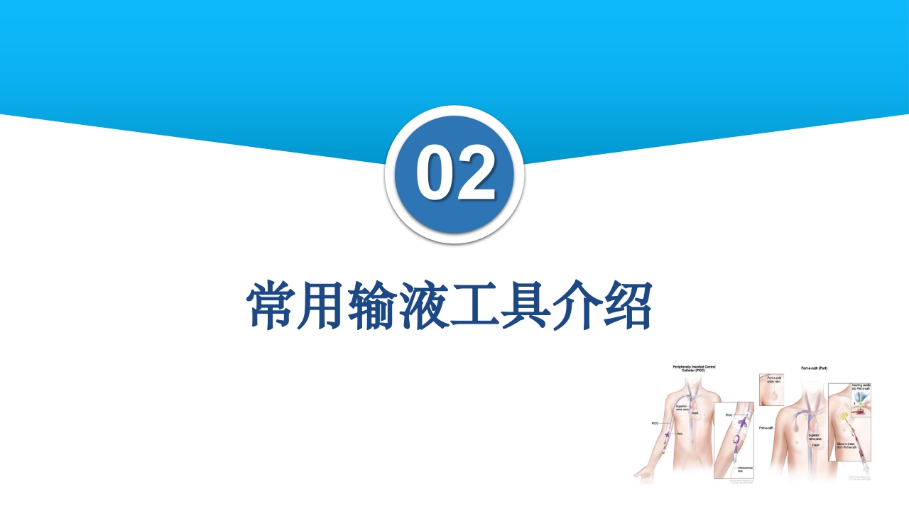 静脉输液工具的合理选择