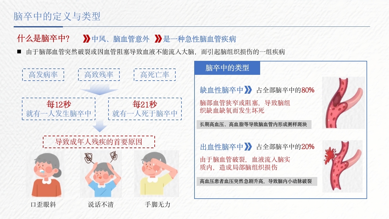脑卒中相关知识