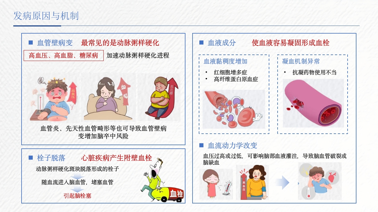 脑卒中相关知识