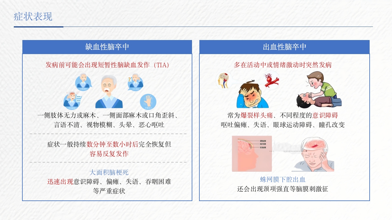 脑卒中相关知识