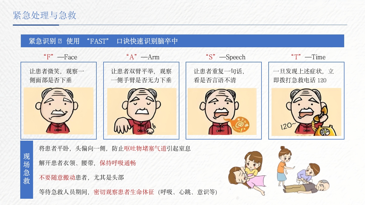 脑卒中相关知识