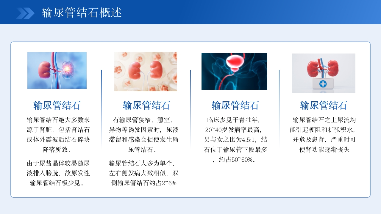 输尿管结石健康宣教