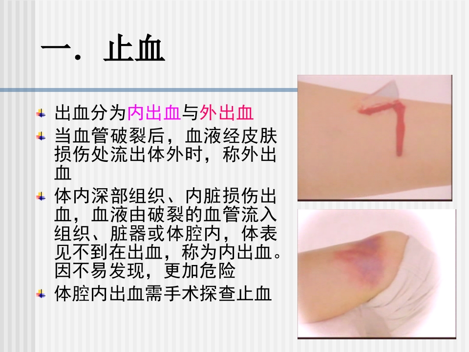 创伤急救四项技术【74页】