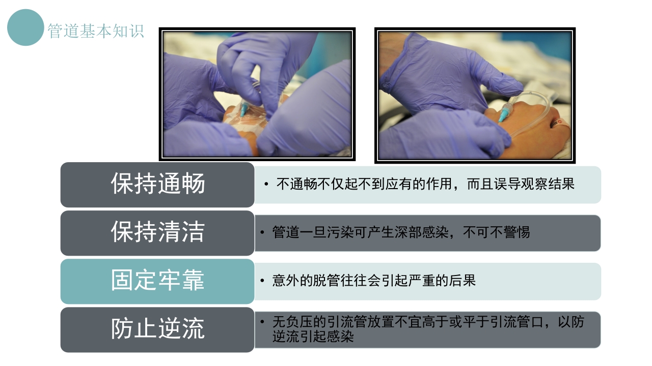 各种常见管理的护理方法